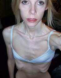 Anorexic photos