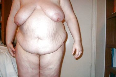 Open Up Marks, Injuries and Saggy