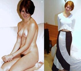 Before after 320.