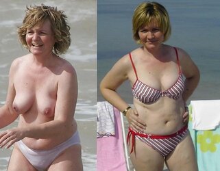 Before after 212.