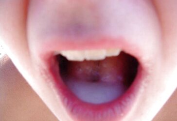 AMATEURS, TEENAGERS, WIVES and TARTS