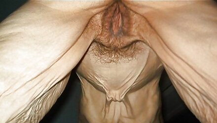 Puckered flesh