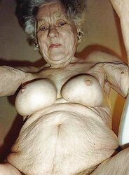 Puckered flesh