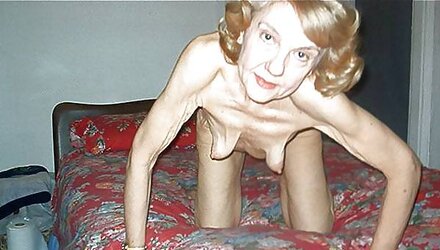 Puckered flesh