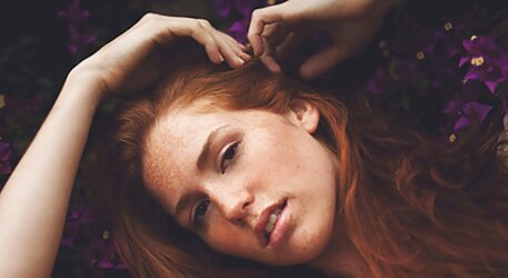 Freckled Ladies