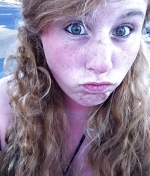 Freckled Ladies