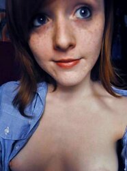 Freckled Ladies
