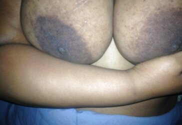 Fat dark-hued areolas meaty bevy part