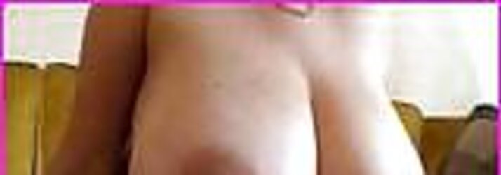 Gigantic areolas