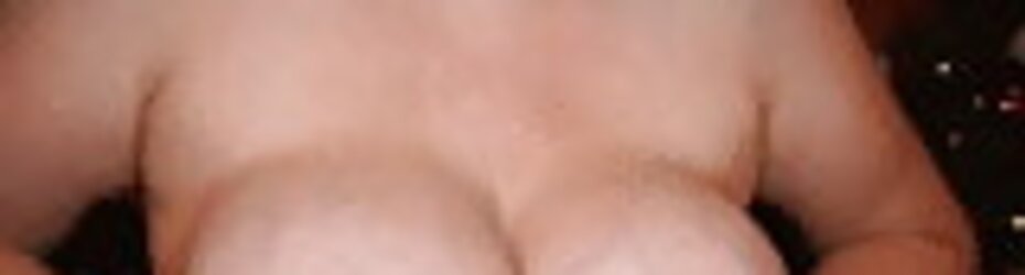 Gigantic areolas