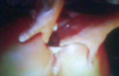 Open bum for going knuckle deep!