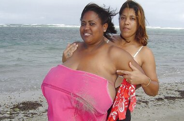 All congenital (beach showing