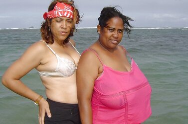 All congenital (beach showing