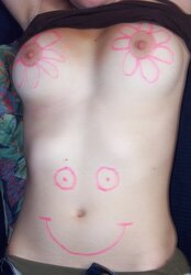 EXGF seins