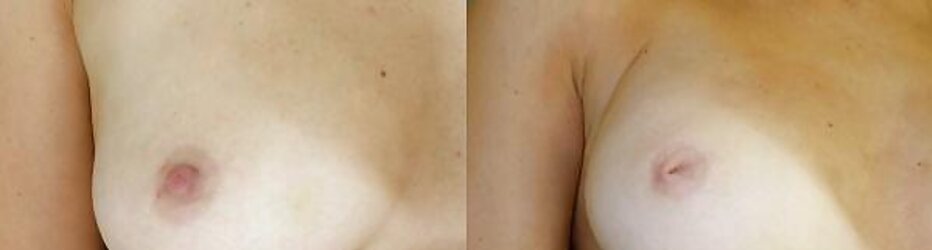 Selection of nymphs and damsels with inverted nips