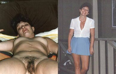 To be bare or not to be bare u prefer