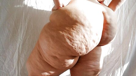 Cellulite All Starlets