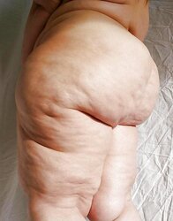 Cellulite All Starlets