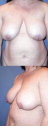 Supreme boobs that make me rigid