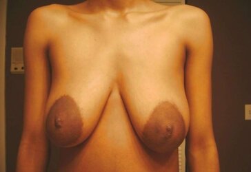 Fat dark-hued areolas ----ample bevy---- part