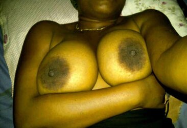 Fat dark-hued areolas ----ample bevy---- part