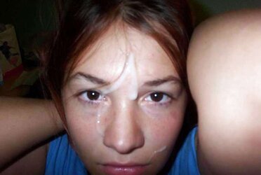 FLEDGLING - FACIALS