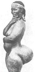 STEATOPYHGIA