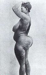 STEATOPYHGIA