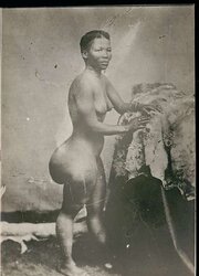 STEATOPYHGIA