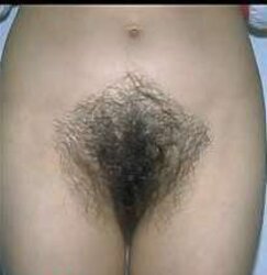 Unshaved Girls