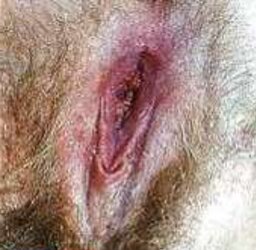Unshaved Girls