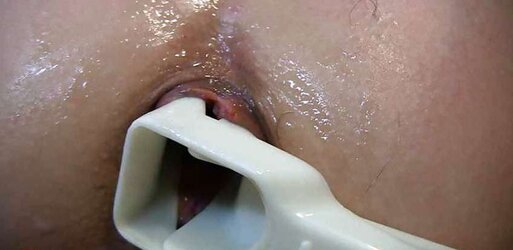 Rectal ass-plug