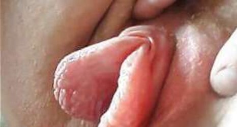 Grosse heraushaengende Schamlippen