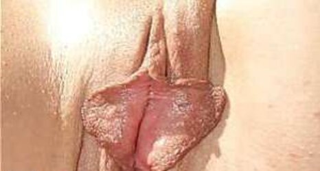 Grosse heraushaengende Schamlippen