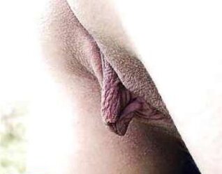 Grosse heraushaengende Schamlippen