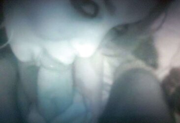 Stella B. (Images From Phone)