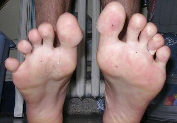 My soles and arse, again