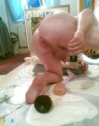 Reinigung Dickdarm