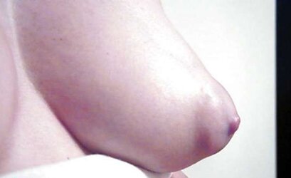 Some lovely nips