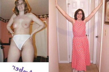 Before after 281.