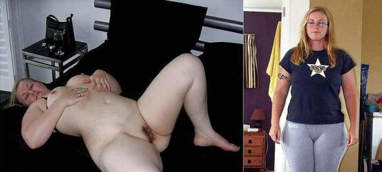 Before after 281.