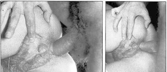 Ass Fucking Erotica - Supersex
