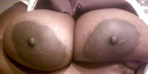 Immense dark-hued areolas ----meaty bevy