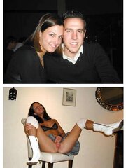 Before After 162.