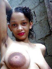 FAT Areola Latin
