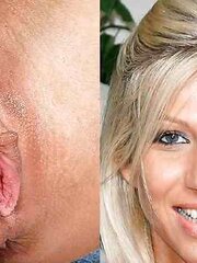 Set of lips