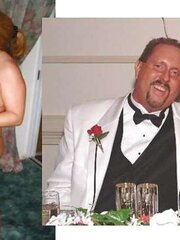 Before After 122.
