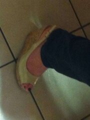 Piedi zia-sole
