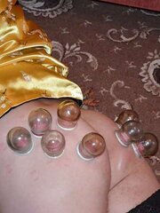 Ache for backside