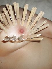 Breast Teaching Session